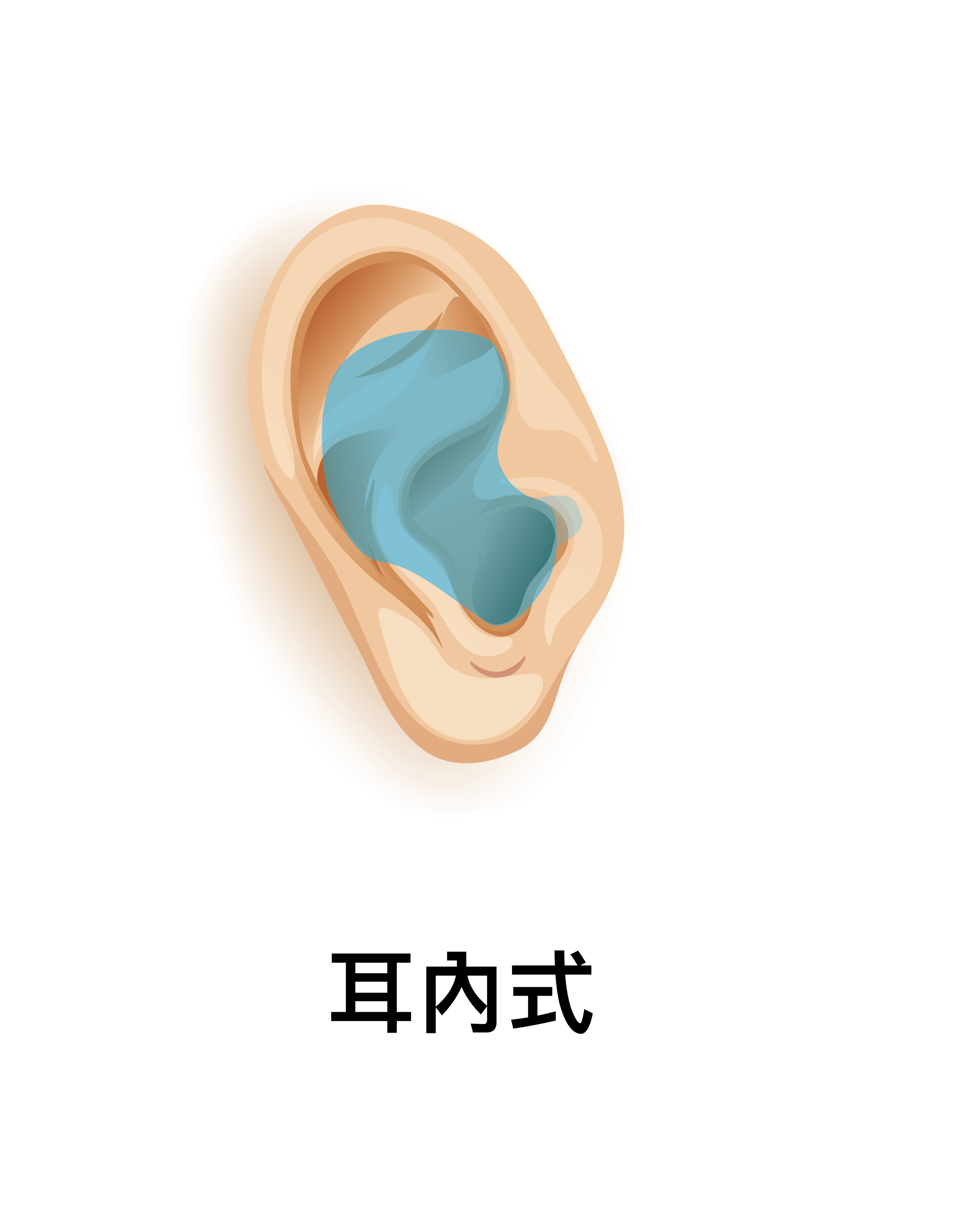 耳內型(ITE)助聽器