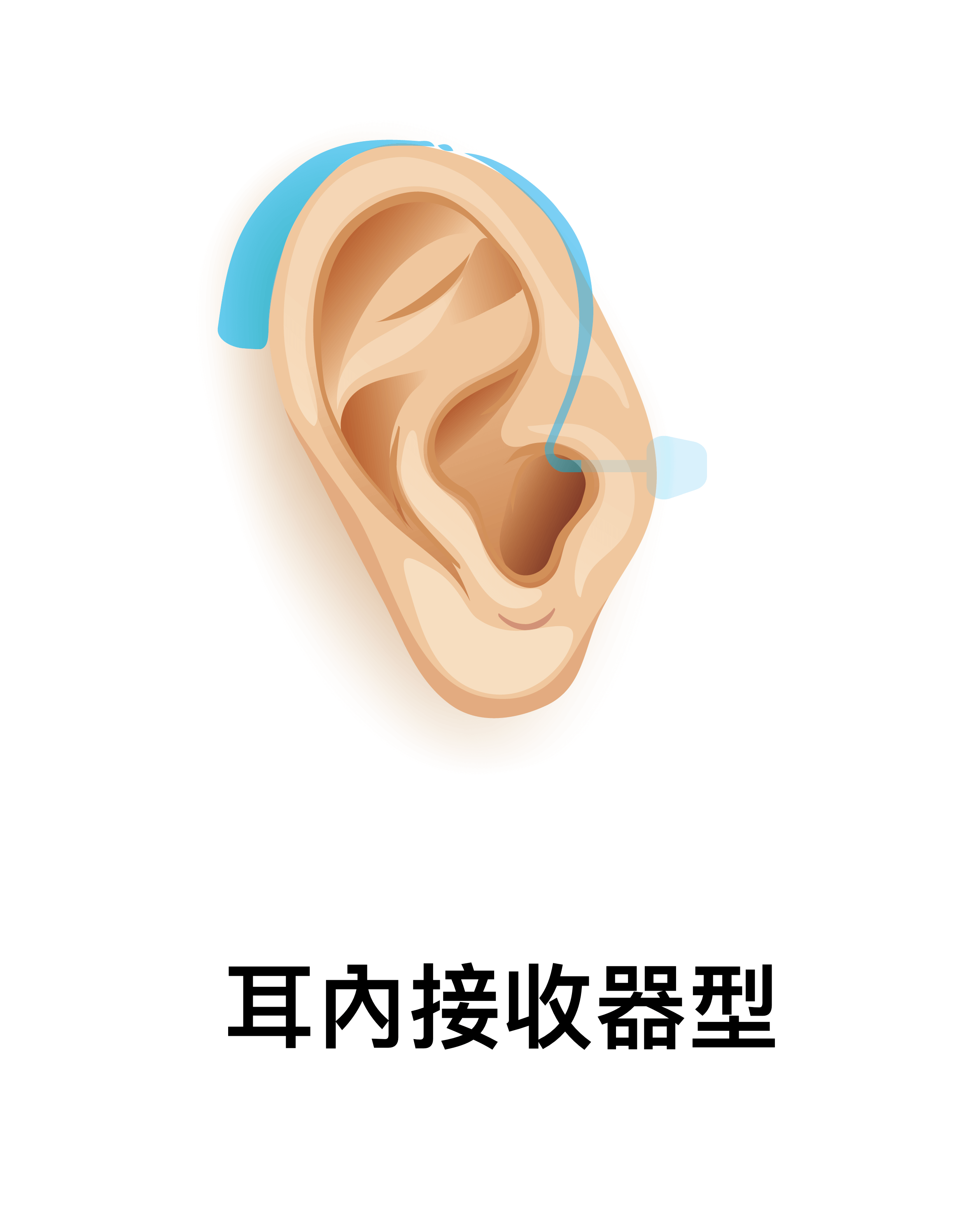 耳内接收器型(RIC/RITE)助听器